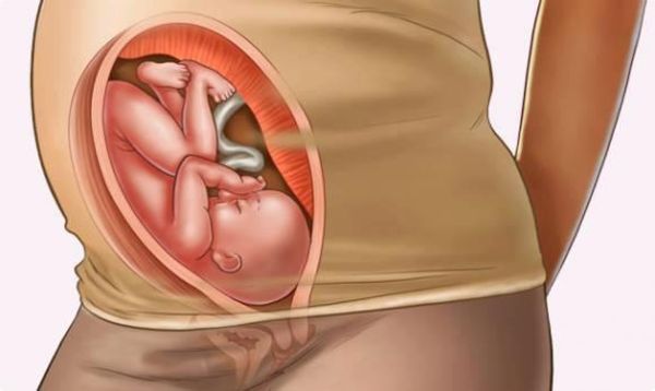 gebeliğin 8. ayında bebeğin anne karnındaki duruşu