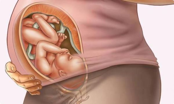 gebeliğin 9. ayında bebeğin anne karnındaki görüntüsü